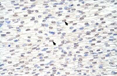 Immunohistochemistry-Paraffin: GRHL3 Antibody [NBP1-80356]
