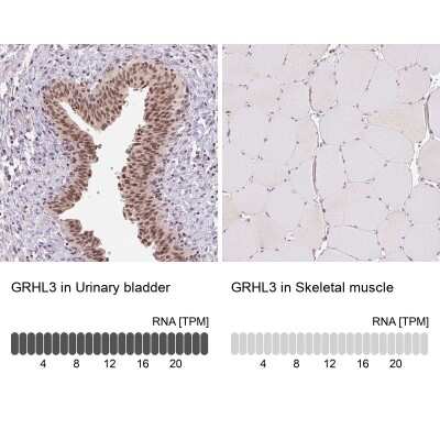 Immunohistochemistry-Paraffin: GRHL3 Antibody [NBP2-57087]