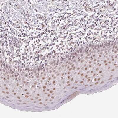Immunohistochemistry-Paraffin: GRHL3 Antibody [NBP2-57087]