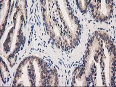 Immunohistochemistry-Paraffin: GRHPR Antibody (OTI2H4) [NBP2-03348]