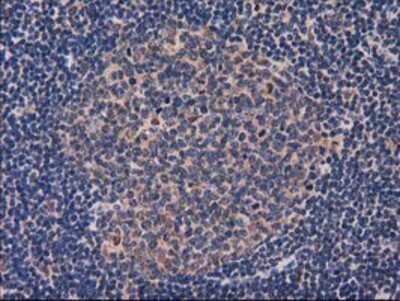 Immunohistochemistry-Paraffin: GRHPR Antibody (OTI2H4) [NBP2-03348]