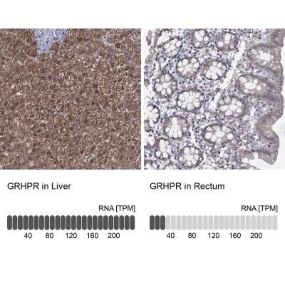 Immunohistochemistry-Paraffin: GRHPR Antibody [NBP3-17036]