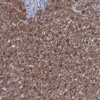 Immunohistochemistry-Paraffin: GRHPR Antibody [NBP3-17036]