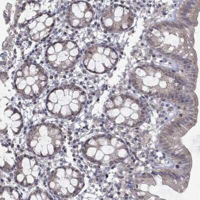 Immunohistochemistry-Paraffin: GRHPR Antibody [NBP3-17036]
