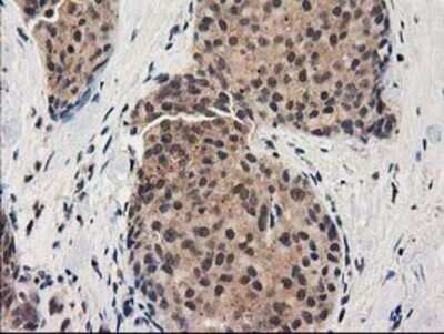 Immunohistochemistry: GRHPR Antibody (OTI2H4) - Azide and BSA Free [NBP2-71430]
