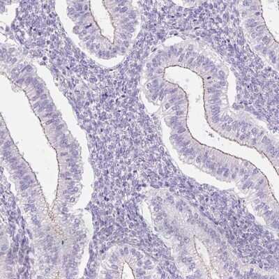 Immunohistochemistry-Paraffin: GRID2 Antibody [NBP2-31632]