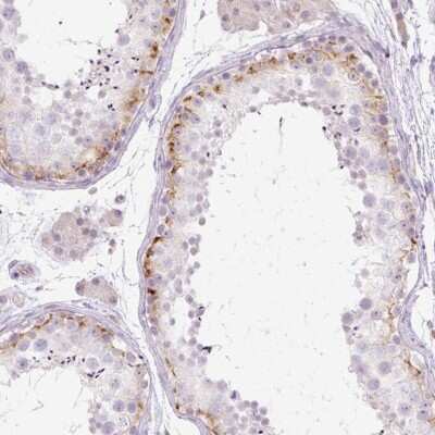 Immunohistochemistry-Paraffin: GRID2 Antibody [NBP2-31632]