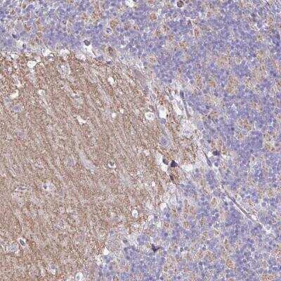 Immunohistochemistry-Paraffin: GRID2 Antibody [NBP2-31723]