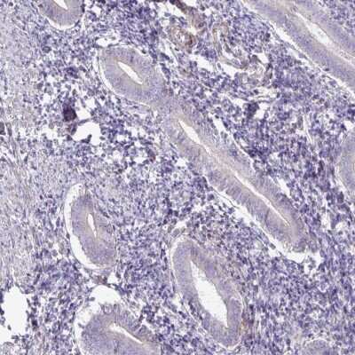 Immunohistochemistry-Paraffin: GRID2 Antibody [NBP2-31723]