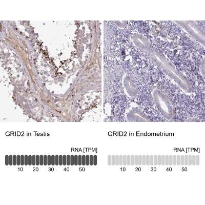 Immunohistochemistry-Paraffin: GRID2 Antibody [NBP2-31723]
