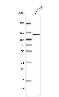 Western Blot: GRID2IP Antibody [NBP1-94174]