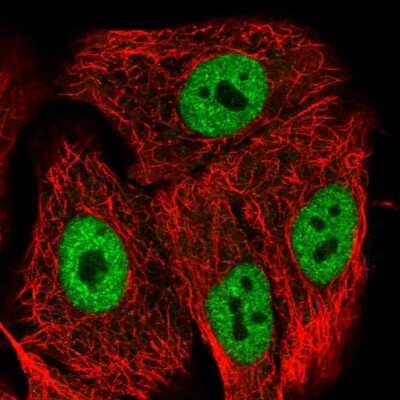 Immunocytochemistry/ Immunofluorescence: GRINL1A Antibody [NBP2-57432]