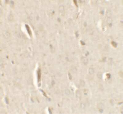Immunohistochemistry: GRIP1 Antibody - BSA Free [NBP2-41211]