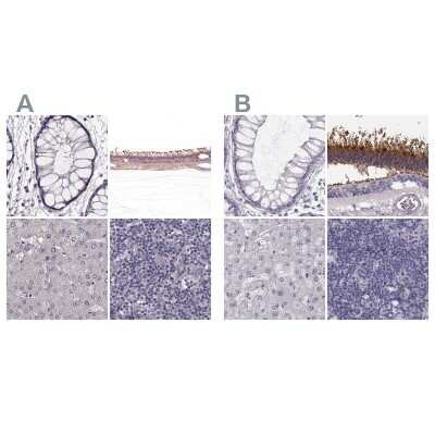 Immunohistochemistry-Paraffin: GRK1 Antibody [NBP2-55226]