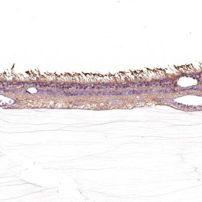 Immunohistochemistry-Paraffin: GRK1 Antibody [NBP2-55226]