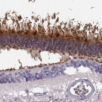 Immunohistochemistry-Paraffin: GRK1 Antibody [NBP2-55732]