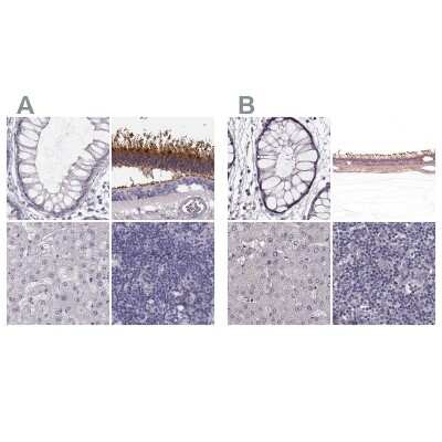 Immunohistochemistry-Paraffin: GRK1 Antibody [NBP2-55732]
