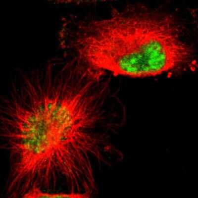 Immunocytochemistry/ Immunofluorescence: GRK3 Antibody [NBP1-90008]