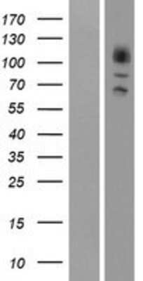 Western Blot: GRK3 Overexpression Lysate [NBP2-10488]