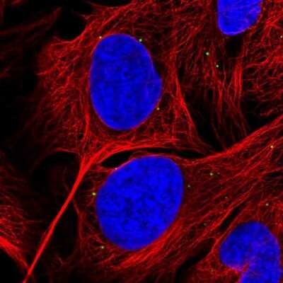 Immunocytochemistry/ Immunofluorescence: GRK4 Antibody [NBP2-55415]