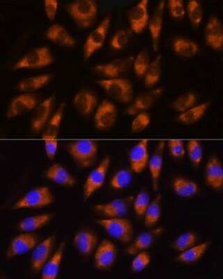 Immunocytochemistry/ Immunofluorescence: GRK5 Antibody - BSA Free [NBP3-04998]