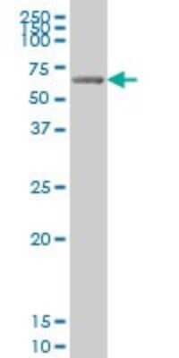 Western Blot: GRK6 Antibody (8B7) [H00002870-M07]
