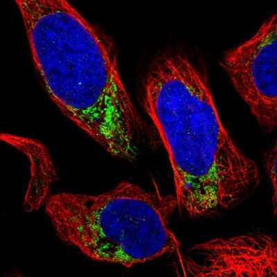 Immunocytochemistry/ Immunofluorescence: GRK6 Antibody [NBP1-83334]
