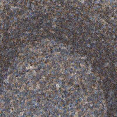 Immunohistochemistry-Paraffin: GRK6 Antibody [NBP1-83334]