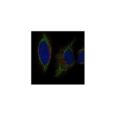 Immunocytochemistry/ Immunofluorescence: GRK7 Antibody [NBP3-17500]