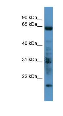 Western Blot: GRK7 Antibody [NBP1-68989]