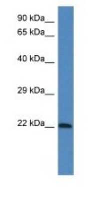 Western Blot: GRP Antibody [NBP1-91457]