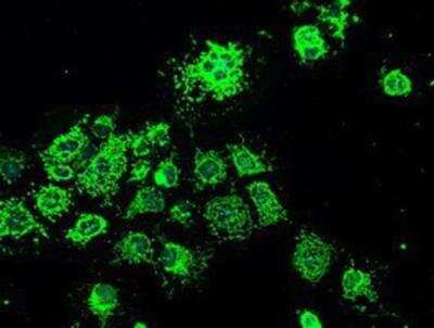 Immunocytochemistry/ Immunofluorescence: GRP75/HSPA9B/Mortalin Antibody (OTI9F8) [NBP1-47801]