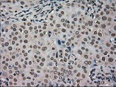 Immunohistochemistry-Paraffin: GRP75/HSPA9B/Mortalin Antibody (OTI9F8) [NBP1-47801]