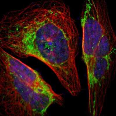 Immunocytochemistry/ Immunofluorescence: GRP75/HSPA9B/Mortalin Antibody [NBP1-89729]