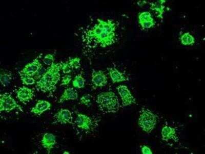 Immunocytochemistry/ Immunofluorescence: GRP75/HSPA9B/Mortalin Antibody (OTI9F8) - Azide and BSA Free [NBP2-70963]