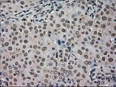 Immunohistochemistry: GRP75/HSPA9B/Mortalin Antibody (OTI9F8) - Azide and BSA Free [NBP2-70963]