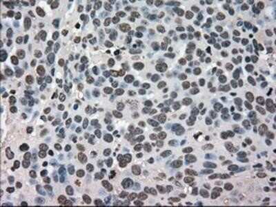Immunohistochemistry: GRP75/HSPA9B/Mortalin Antibody (OTI9F8) - Azide and BSA Free [NBP2-70963]