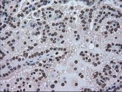 Immunohistochemistry: GRP75/HSPA9B/Mortalin Antibody (OTI9F8) - Azide and BSA Free [NBP2-70963]