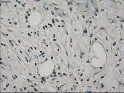 Immunohistochemistry: GRP75/HSPA9B/Mortalin Antibody (OTI9F8) - Azide and BSA Free [NBP2-70963]