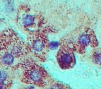 Immunohistochemistry-Paraffin: GRP78/HSPA5 Antibody [NB100-56411]