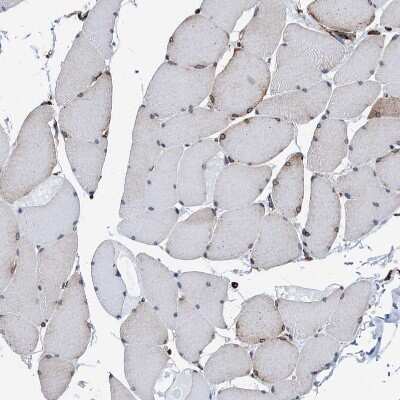 Immunohistochemistry-Paraffin: GRP78/HSPA5 Antibody [NBP1-89969]