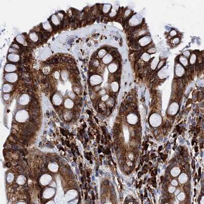 Immunohistochemistry-Paraffin: GRP78/HSPA5 Antibody [NBP1-89969]