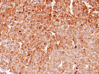 Immunohistochemistry-Paraffin: gp96/HSP90B1/GRP94 Antibody [NBP1-32118]