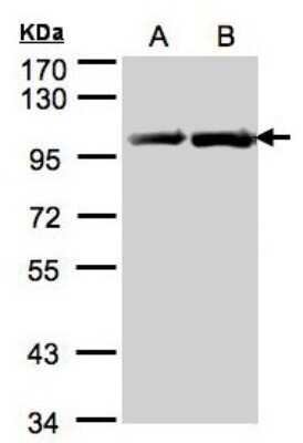 Western Blot: gp96/HSP90B1/GRP94 Antibody [NBP1-32118]