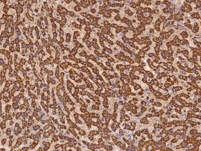 Immunohistochemistry-Paraffin: GRPEL1 Antibody [NBP2-97221]