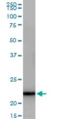 Western Blot: GRPEL1 Antibody [H00080273-B01P]