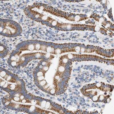 Immunohistochemistry-Paraffin: GRPEL2 Antibody [NBP1-84174]