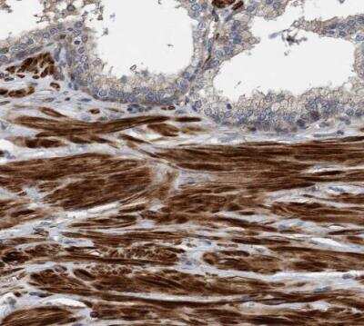 Immunohistochemistry-Paraffin: GRPEL2 Antibody [NBP1-85099]