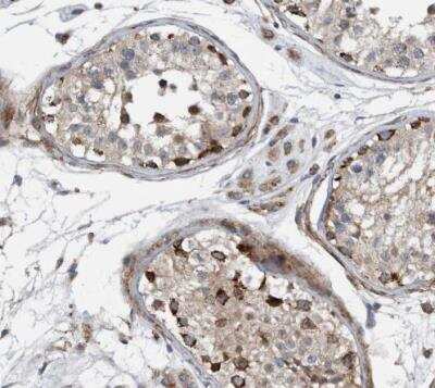 Immunohistochemistry-Paraffin: GRPEL2 Antibody [NBP1-85099]