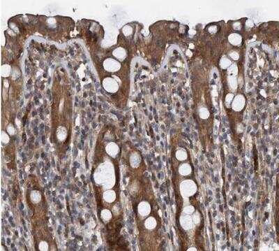 Immunohistochemistry-Paraffin: GRPEL2 Antibody [NBP1-85099]